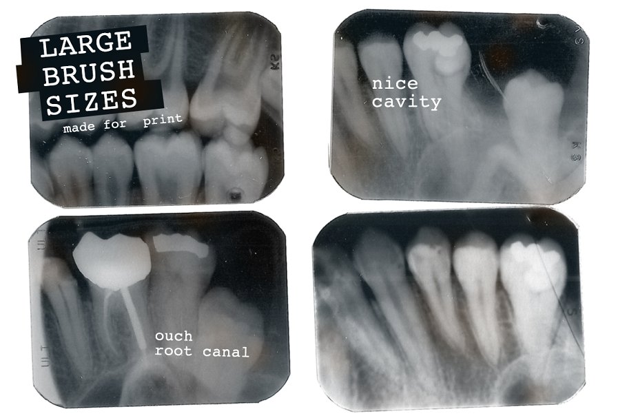 牙科X光射线影像PS笔刷 Dental X-ray Brushes插图(3)