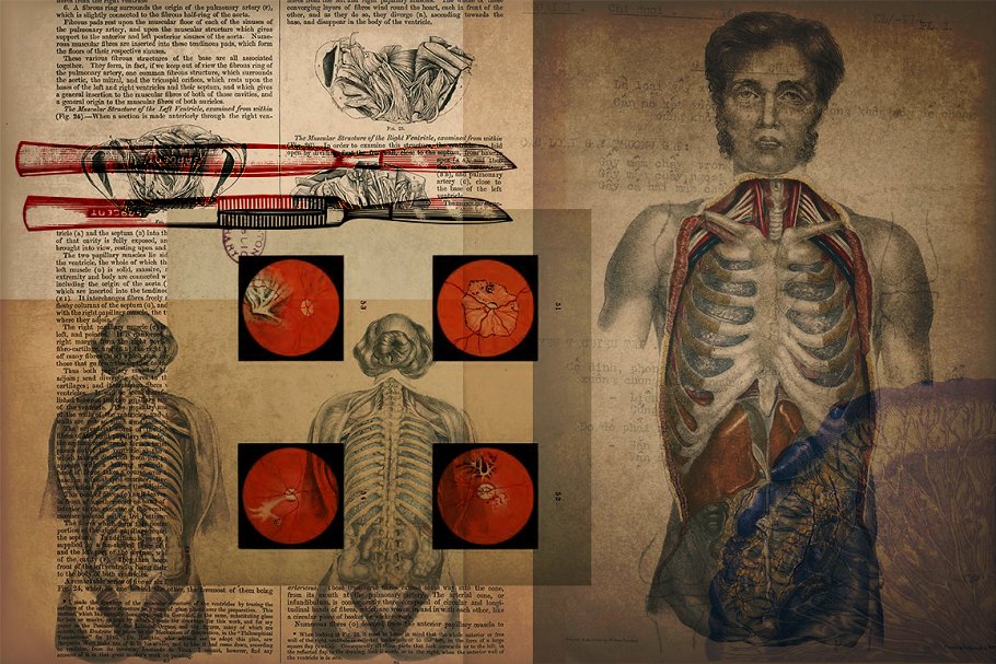 旧时代解剖医学插图素材 Medical Art | 110 EPS, PNG and JPG’s插图1
