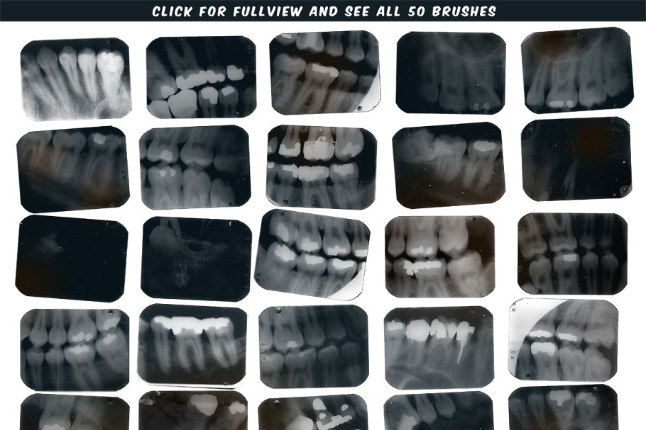 牙科X光射线影像PS笔刷 Dental X-ray Brushes插图2
