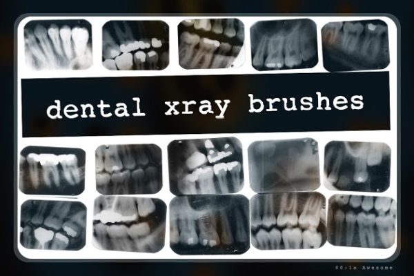 牙科X光射线影像PS笔刷工具素材 Dental X-ray Brushes