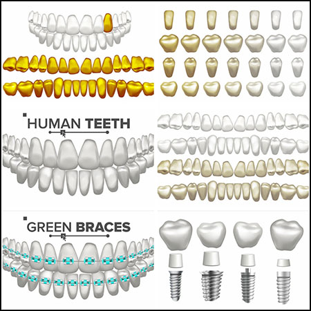 牙齿种植牙齿矫正蚂蚁素材网矢量插图精选